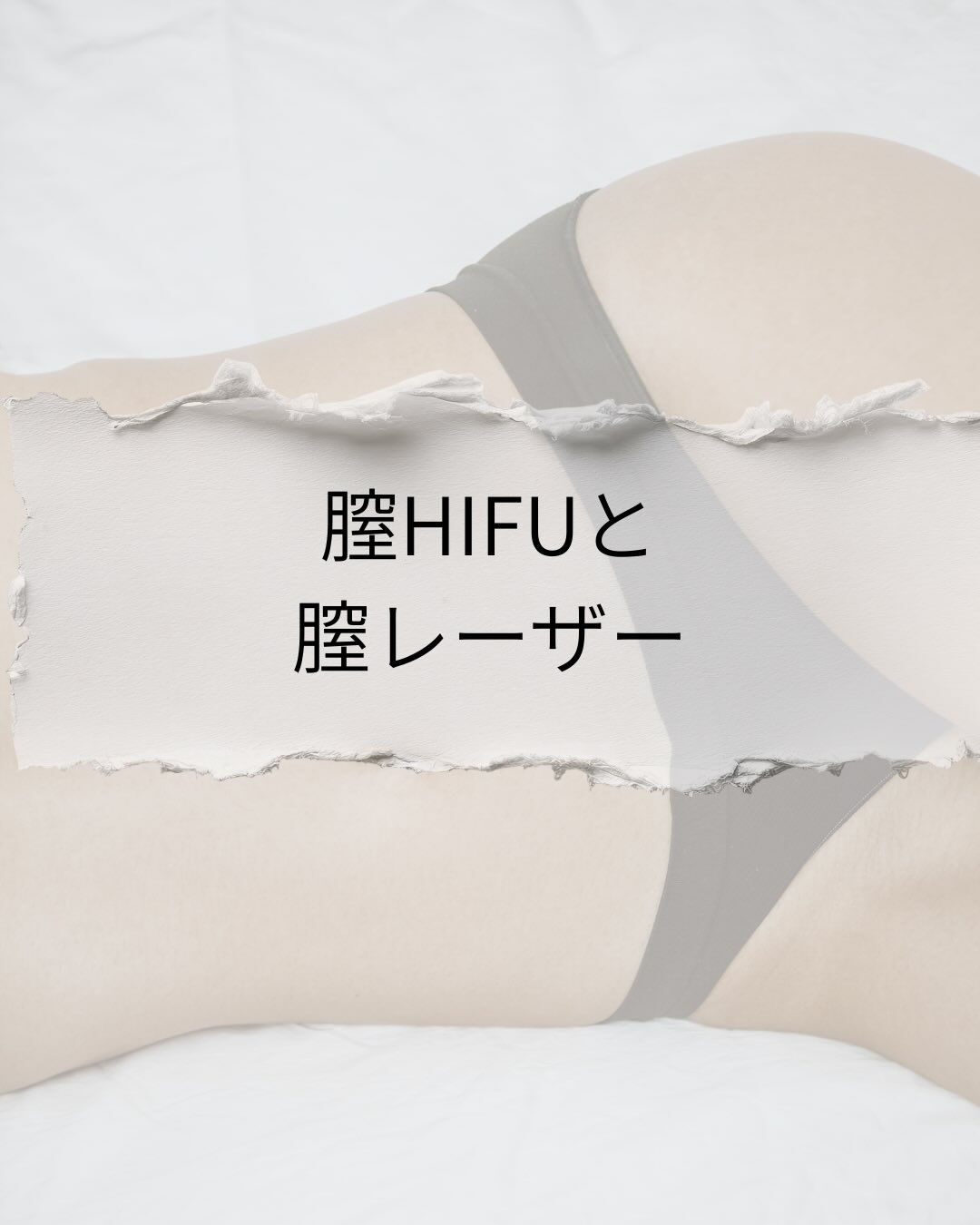 膣レーザーや膣ハイフ